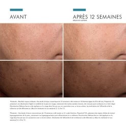 Siero Visage Discoloration Defense Anti Taches Brunes 30ml Correct Skinceuticals -Negozi di cosmetici 111550